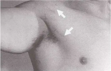 Link: Esteroides anabolizantes androgênicos e seus efeitos colaterais: uma revisão crítico-científica